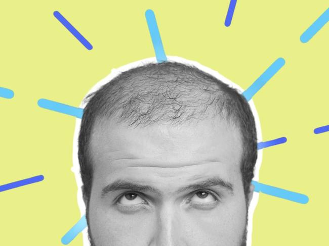 Balding is optional, the experts say, if you are prepared to seek treatment early enough.