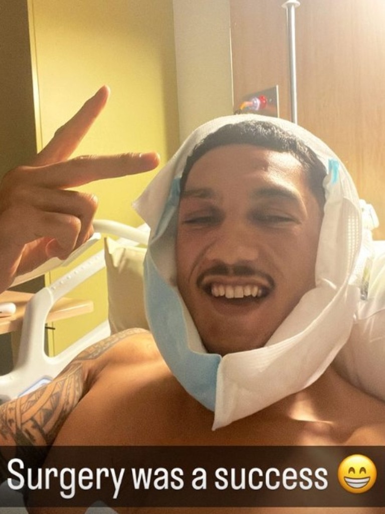 Jai Opetaia has had the surgery. Photo: Instagram