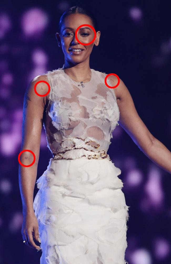 Mel B returned to the X Factor covered in bruises, and not wearing her wedding ring. Picture: Corbis