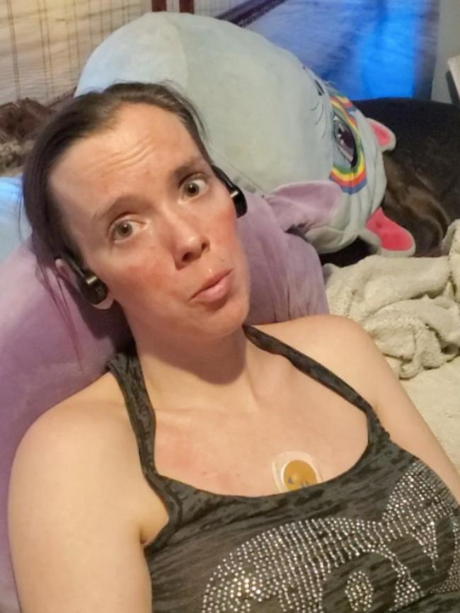 A former musician has opened up about her debilitating experience with a disease that affects just one in a million people. Picture: Supplied