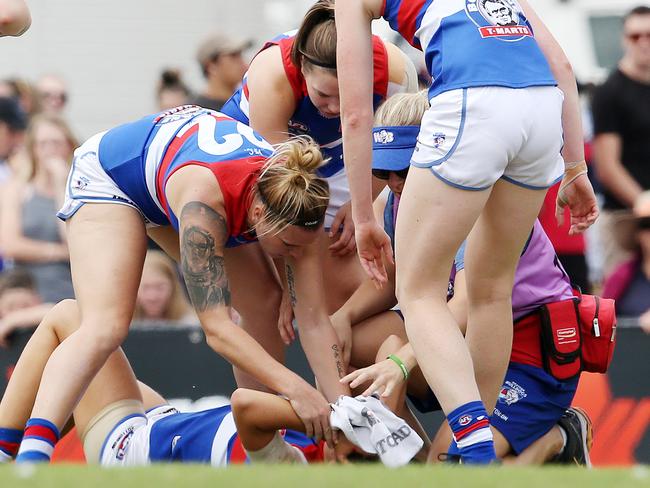 Bulldogs players attend to Libby Birch after she copped a heavy first-term bump. Picture: Michael Klein