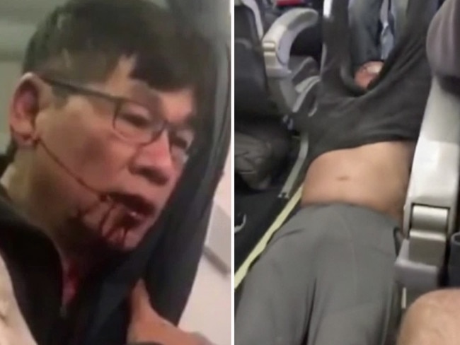 Dr David Dao was controversially dragged off a flight in April. Picture: AP