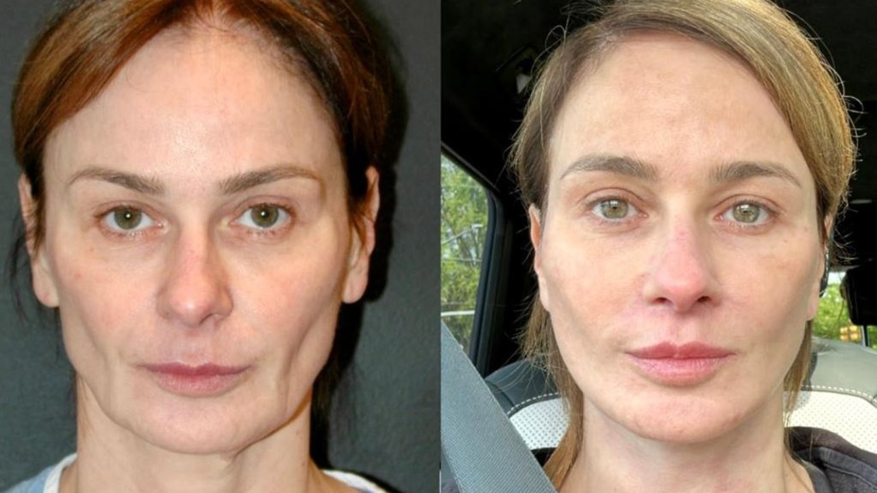 Plastic surgeon shows off shocking 'age-reversing' results from