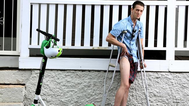 Chef Daniel Follett shows the scars from recent surgery to repair his cracked femur after falling a Lime Scooter. Picture AAP/David Clark