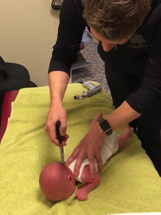 Chiropractor Dr Andrew Arnold uses a tool he describes as an “activator” — a spring-loaded chiropractic thumping device — on its most gentle setting during the filmed consultation.