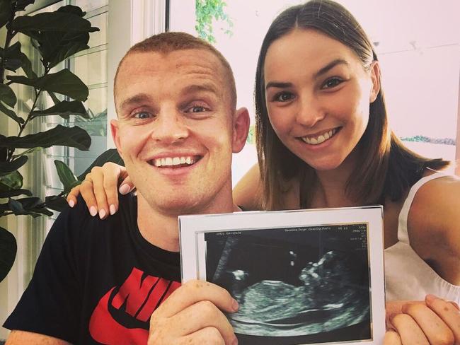 Alex McKinnon and his partner are expecting a baby.