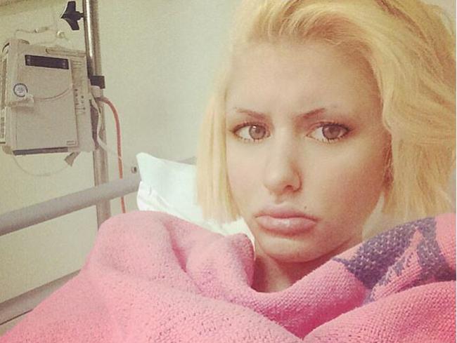Gabi Grecko Denies Her Fall Was A Stunt To Cover Fake Pregnancy Daily 