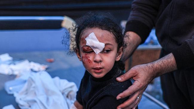 A child injured during Israeli bombardment receives treatment at the Kuwait Hospital in Rafah in the southern Gaza Strip. Picture: AFP