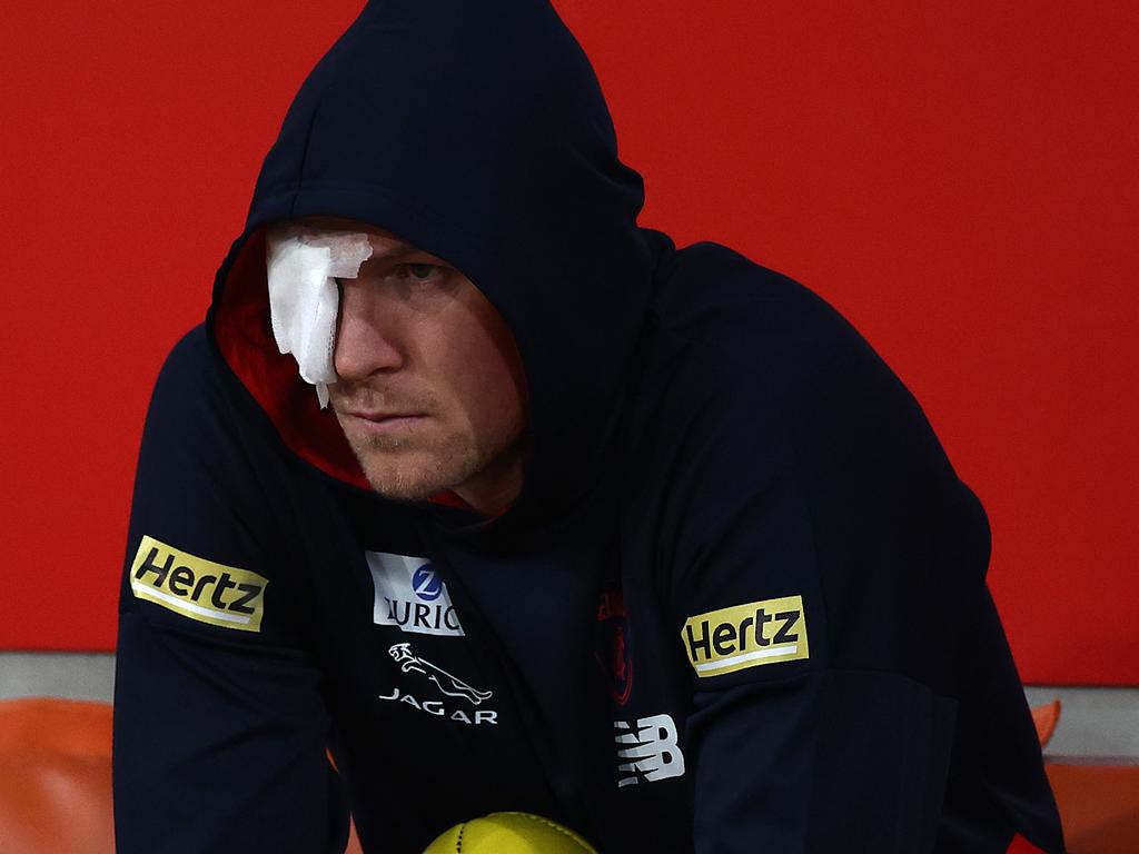 Tom McDonald on the bench after suffering an eye injury last year. Picture: Ryan Pierse/AFL Photos/via Getty