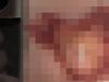 Woman’s gross find after medical procedure
