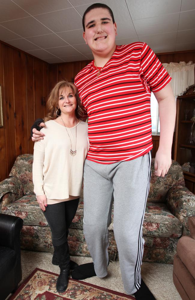 Broc Brown is the world’s tallest teenager Photos NT News