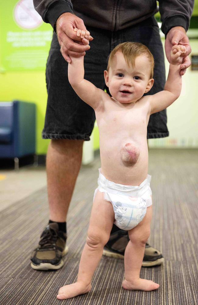 Hunter Allcroft was born with his organs outside of his body. Picture: Mark Stewart