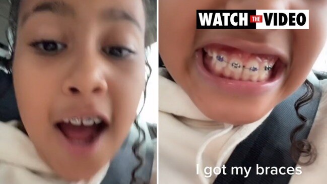 North West shows off her new braces