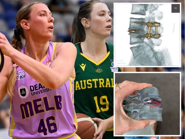 Opals and WNBL star Sara Blicavs has undergone serious spinal surgery.