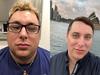 ‘No lines’: Young Aussies obsessed with Botox