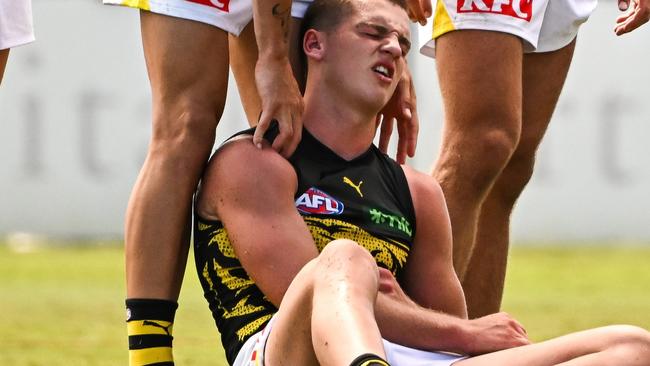 PERTH, AUSTRALIA - FEBRUARY 17: Sam Lalor of the Tigers lays injured during the 2025 AFL Match Simulation between the West Coast Eagles and the Richmond Tigers at Mineral Resources Park on February 17, 2025 in Perth, Australia. (Photo by Daniel Carson/AFL Photos via Getty Images)