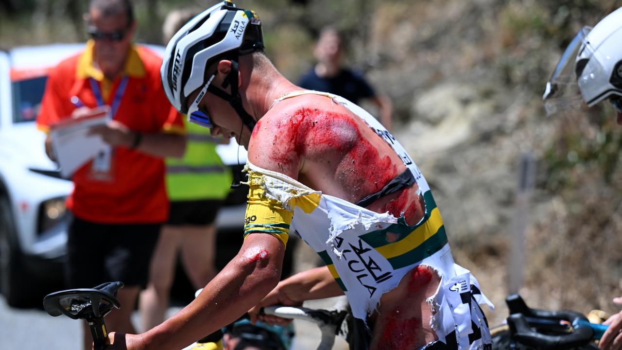 Cyclist covered in blood after horror crash