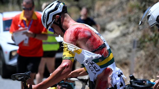 CAMPBELLTOWN, AUSTRALIA - JANUARY 18: (EDITORS NOTE: Image depicts graphic content.) Luke Plapp of Australia and Team Jayco AlUla injury after being involved in a crash during the 24th Santos Tour Down Under 2024, Stage 3 a 145.3km stage from Tea Tree Gully to Campbelltown / #UCIWT / on January 18, 2024 in Campbelltown, Australia. (Photo by Tim de Waele/Getty Images)