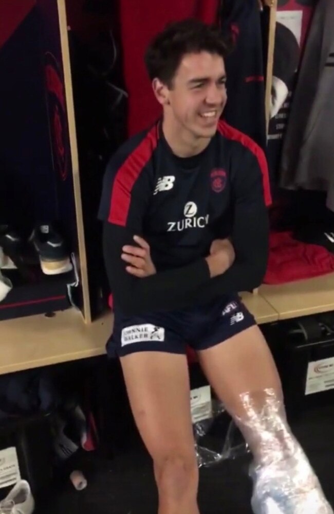 Marty Hore‘s bandaged calf which featured on teammate Angus Brayshaw’s Instagram story.