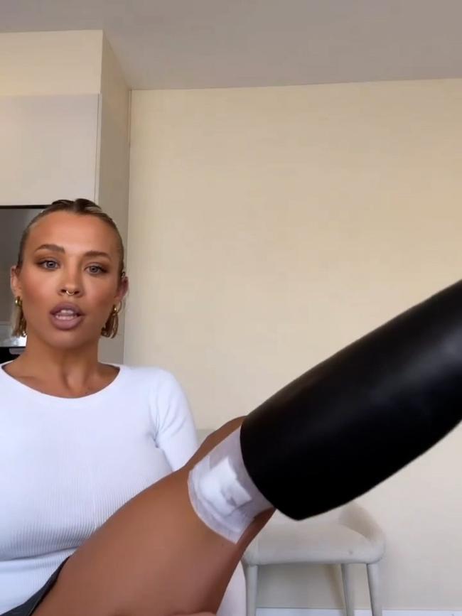 Tammy Hembrow reveals she has had 'big chunk' taken out of the back of her leg following skin cancer discovery. Picture: Instagram @tammyhembrow