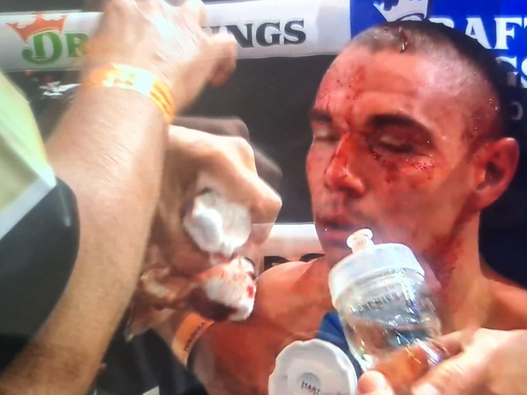 A stray elbow left Tim Tszyu with a deep cut on his head. Picture: Main Event