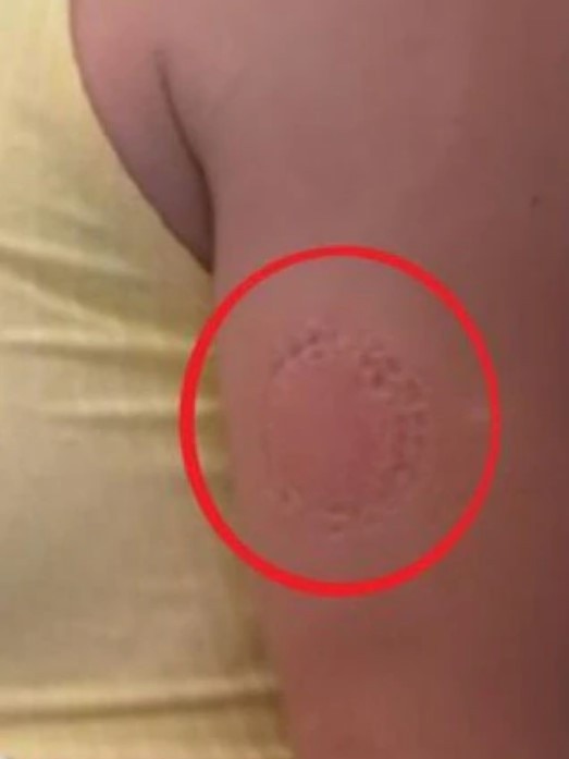 Last year, the round three match was so intense, the frustrated teen left a bite mark on her upper arm. Picture: Fox Sports