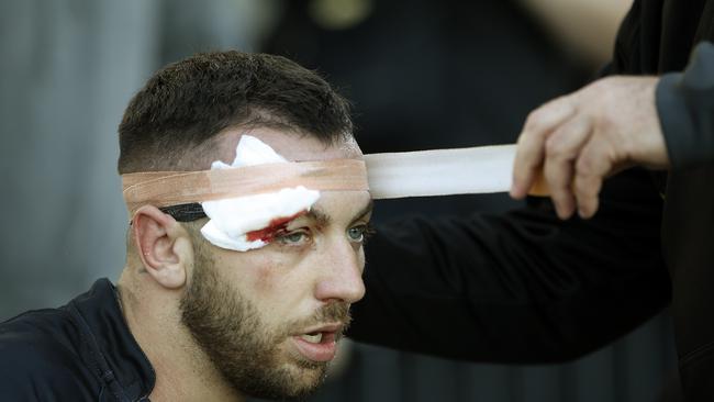 Matraville's Liam Balzan gets bandaged up. Picture: John Appleyard