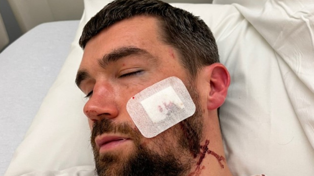 Socceroos captain Mat Ryan injury. Pic: X