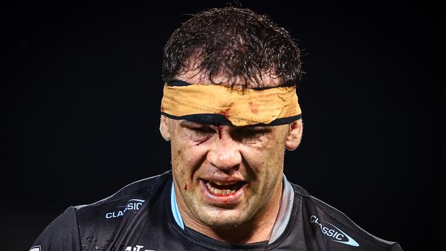 Kent: NRL sanctions fix to clear dark concussion shadow