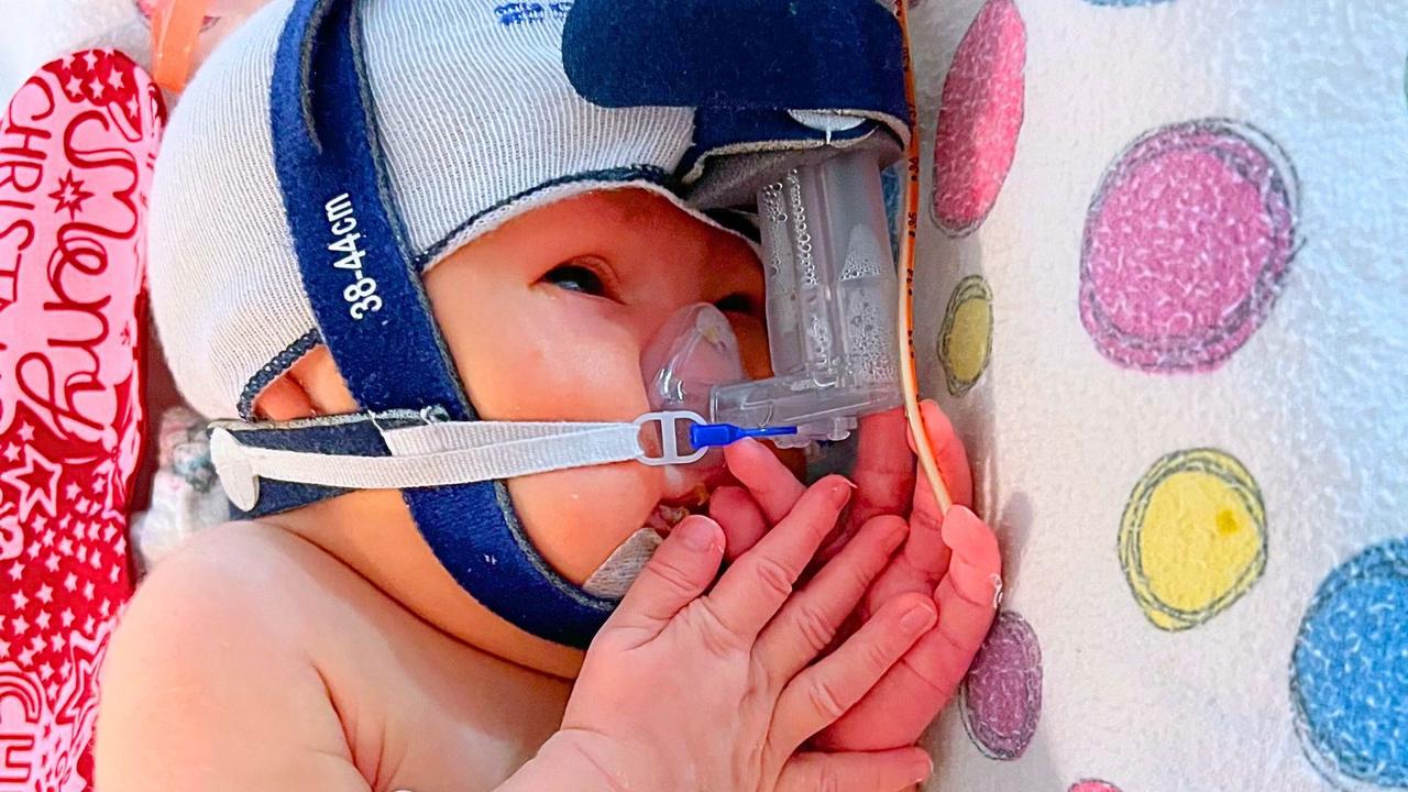 Critically-ill bub overcomes odds after 250km life-or-death flight