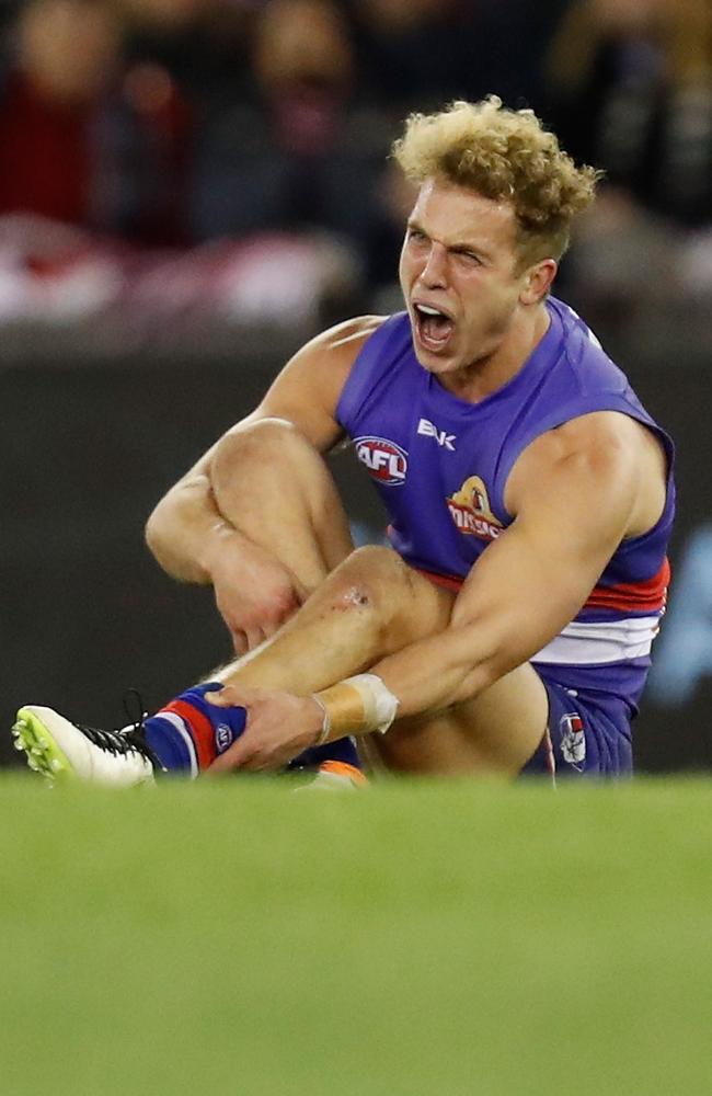 Mitch Wallis grabs his broken leg. Picture: Getty Images