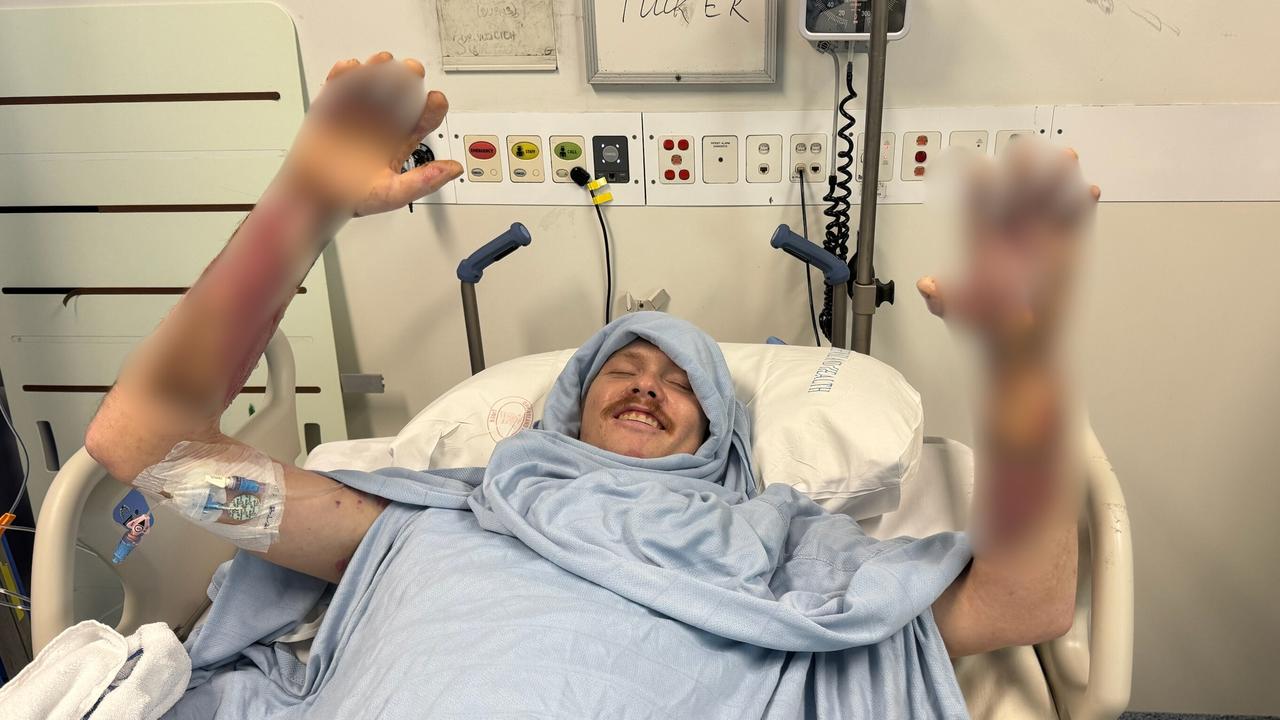 ‘Trapped’: Tradie’s plea to workers after 20,000 volt powerline strike