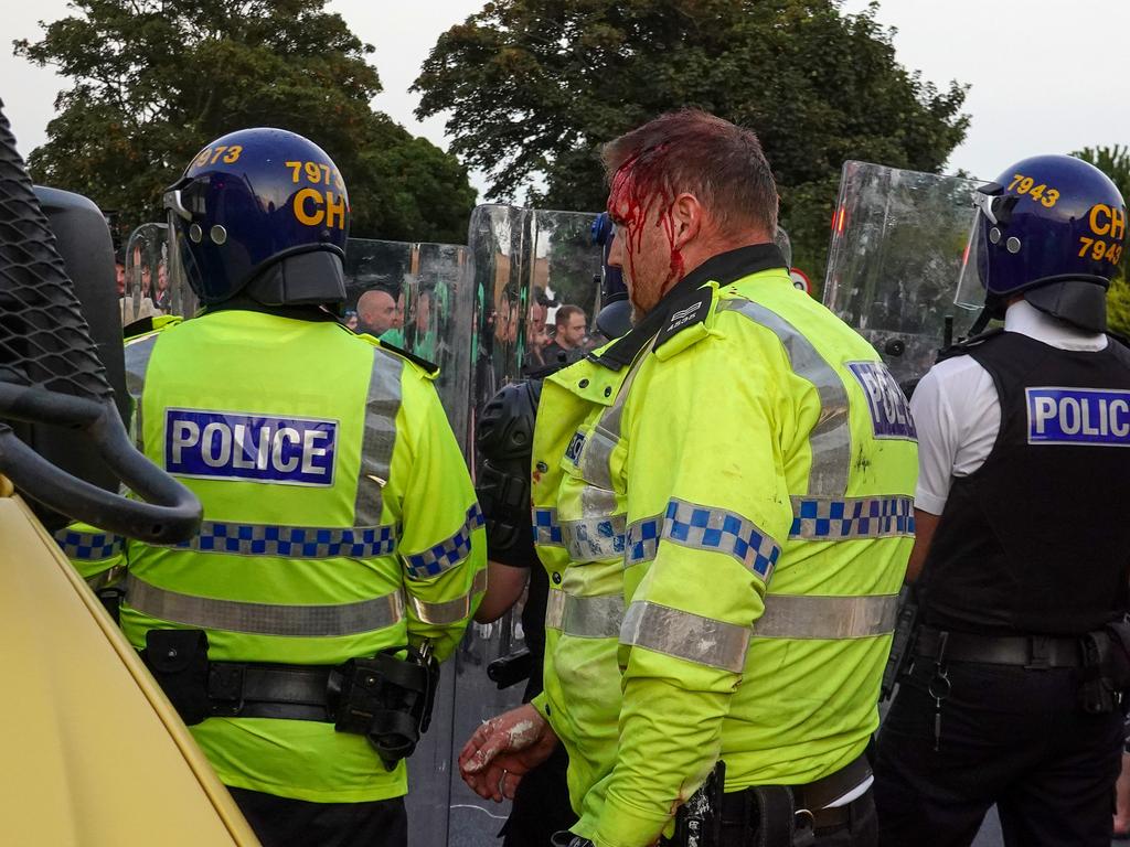 An injured police officer during the riots in Southport. Picture: Getty Images