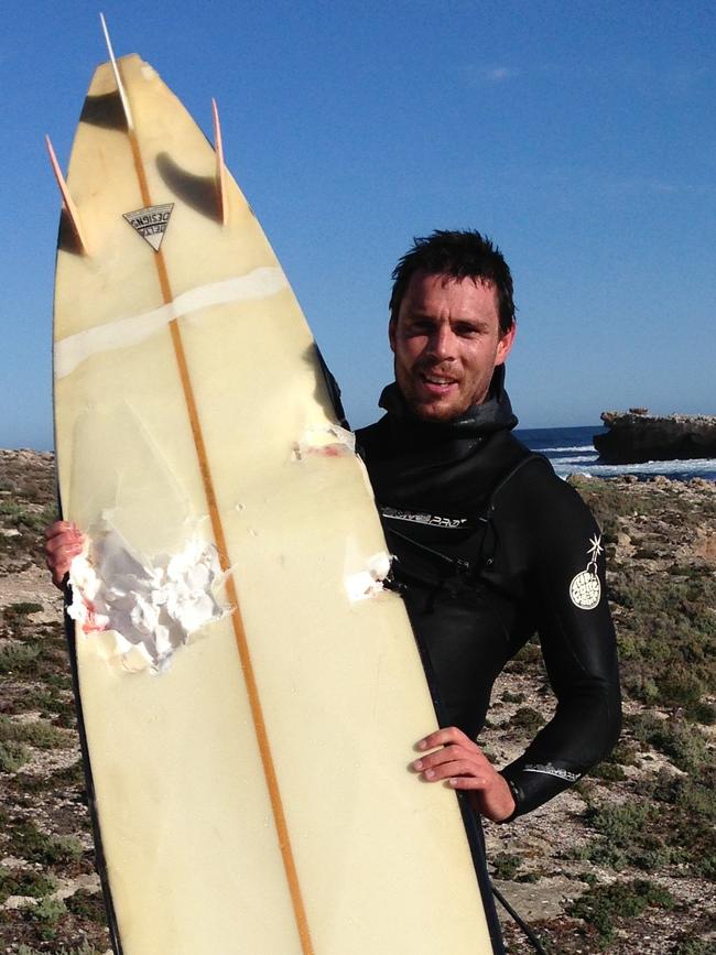 Elliston shark attack victim and mayor Andrew McLeod with his damaged board.