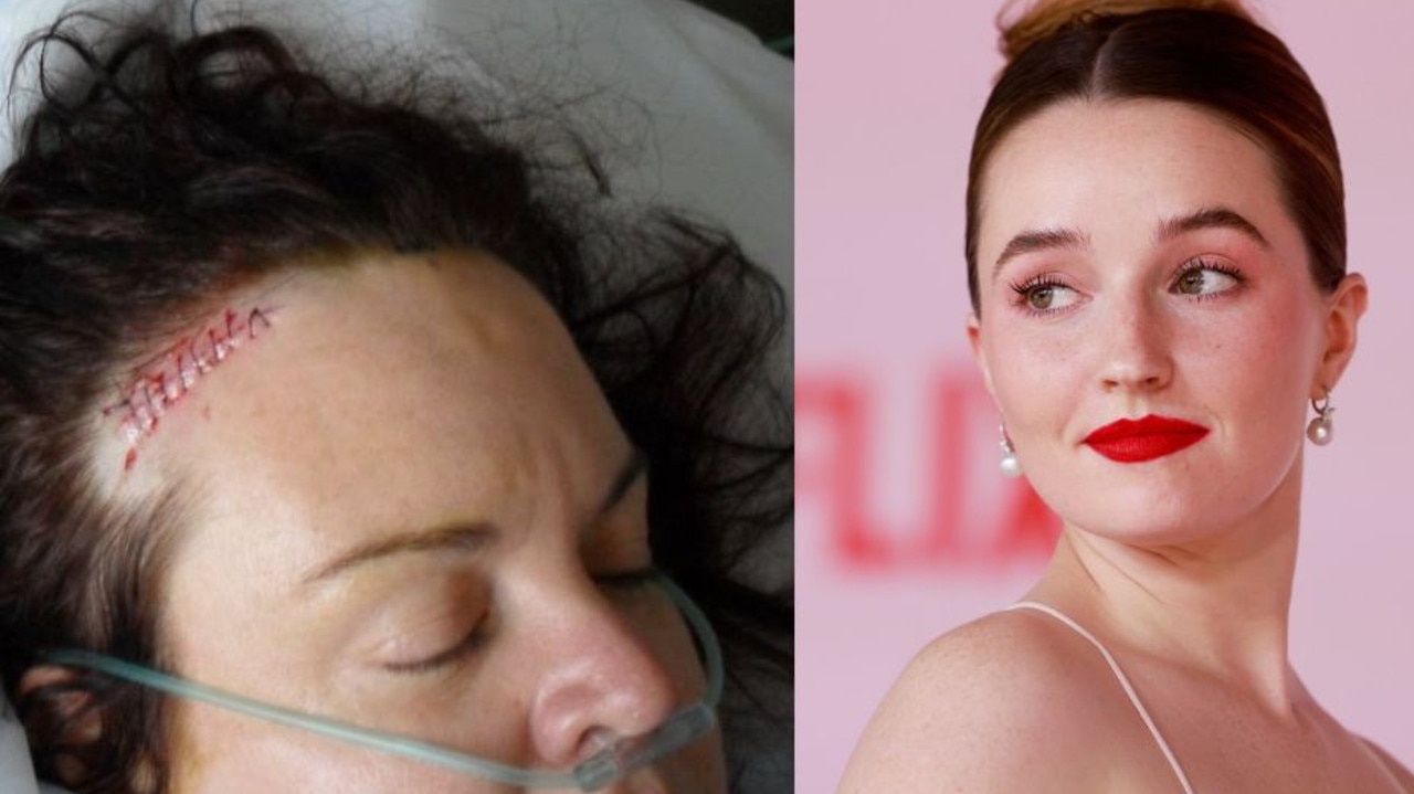 Brain tumour sufferer’s plea amid Apple Cider Vinegar Netflix series