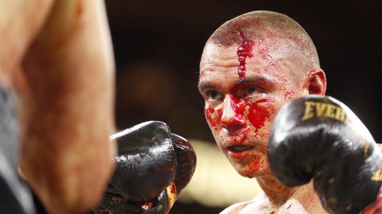 Tszyu’s bloodbath against Fundora could enforce a longer period outside of the ring than he’d like. (Photo by Steve Marcus/Getty Images)