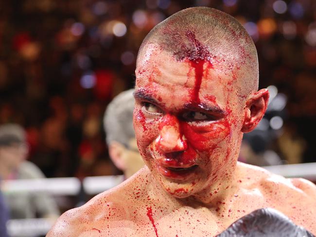 Tim Tszyu required 10 stitches in the cut. Picture: Getty Images