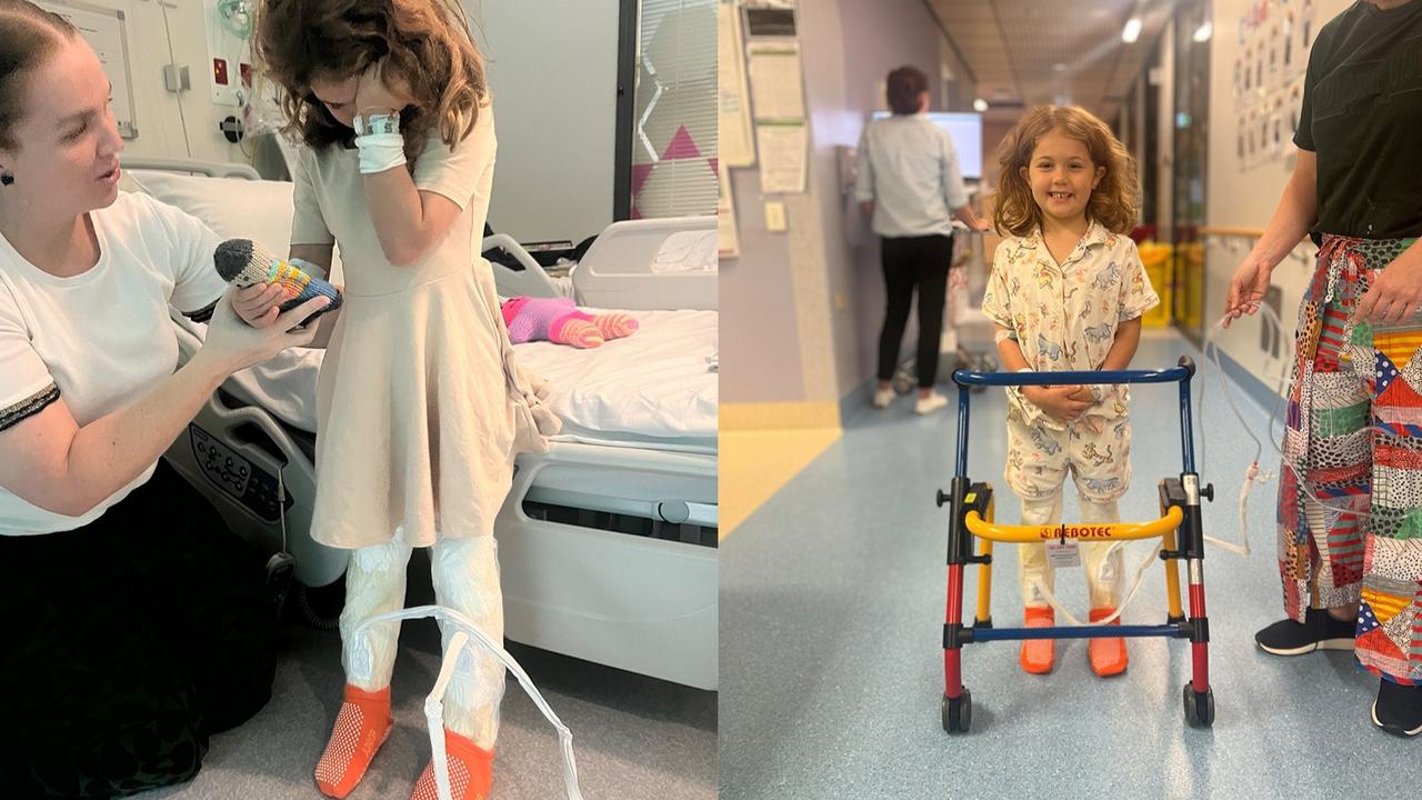 Little Marlow Thurston has a long road to recovery after she sustained significant burns to her legs after a backyard bonfire exploded at her Byfield home.