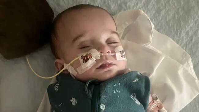 The Bendigo community has rallied behind six-months old baby Ted.