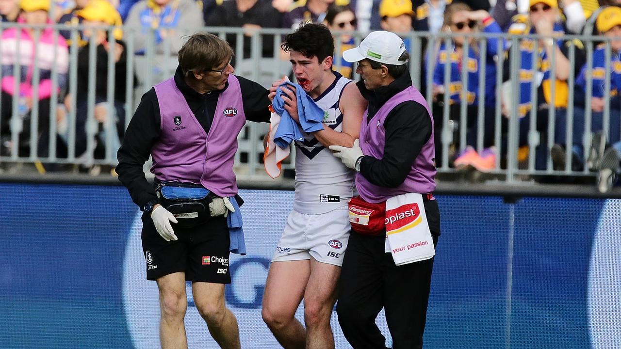 Andrew Brayshaw suffered a broken jaw after the punch. Photo: Will Russell/AFL Media.