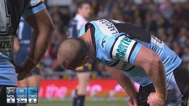 Blood gushes from Jeff Robson’s head after colliding with Jason Taumalolo.