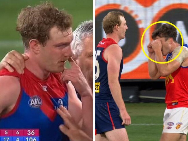 The AFL world has turned on Noah Answerth after the Lions defender reignited a two-year-old feud