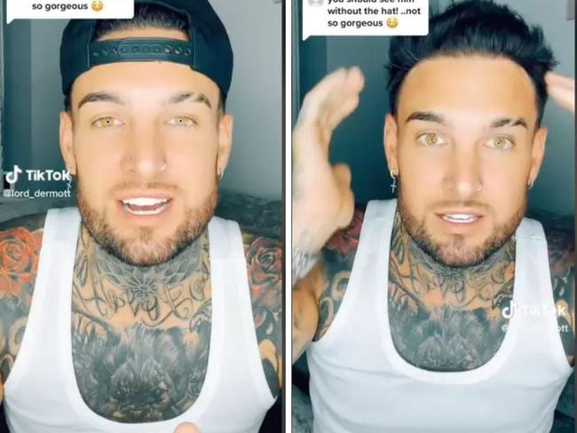 A man has revealed the extreme lengths he went to in order to hide an 'ugly' feature, declaring 'without a hat, I look awful'. Picture: TikTok