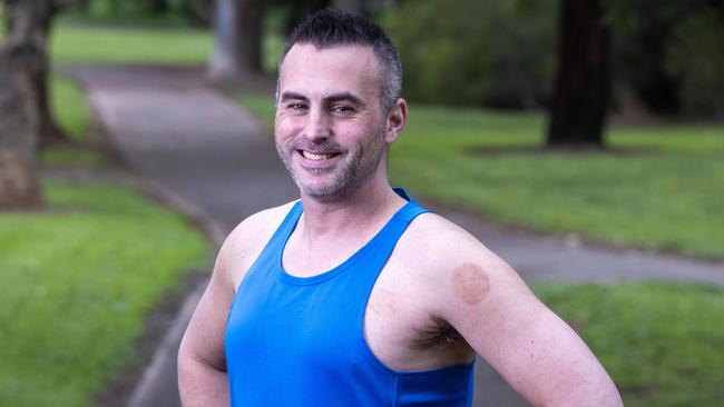 August 25, 2024: Kyle Collis is a 38-year-old cystic fibrosis sufferer about to run his 3rd ultramarathon in light of a new treatment becoming available on the PBS for children aged two years and above in Australia this month.  Picture: Kelly Barnes