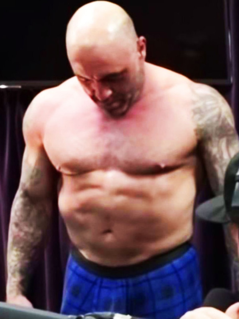 joe rogan vitiligo