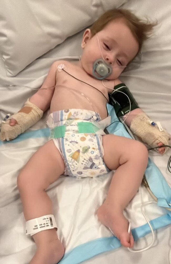 Levi contracted Streptococcus Pneumonia, a bacterial infection which infected his brain, causing him to have encephalitis meningitis which is swelling of the brain. Picture: Supplied