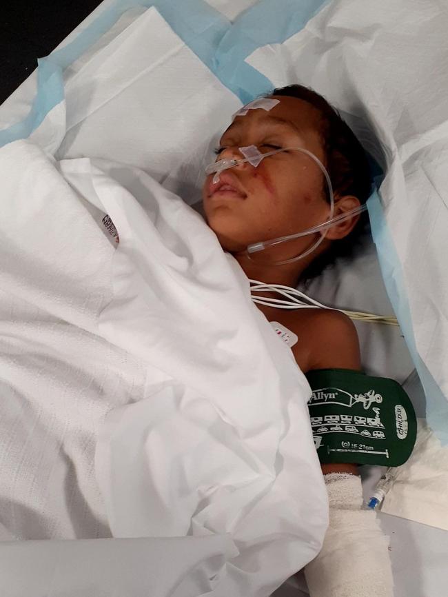 Five-year-old Paikea Hiko was seriously injured in a hit-and-run in Leanyer. Picture: Supplied