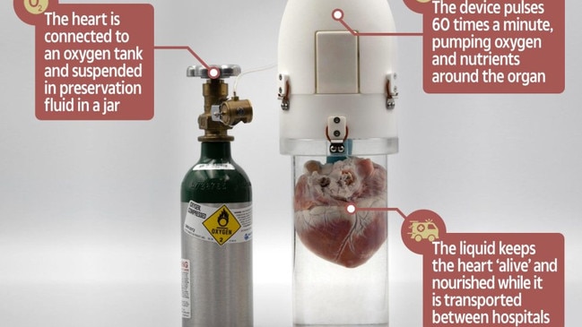 The new heart invention may be a ‘game changer’ for organ transplants. Picture: Supplied