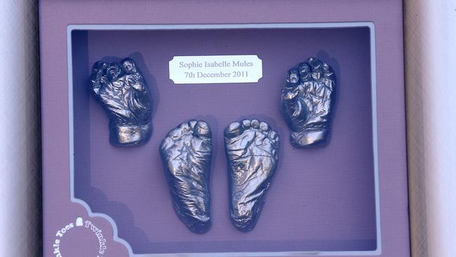 A cast of Sophie’s hands and feet were taken when she was born. Picture: AAP Image/Richard Gosling