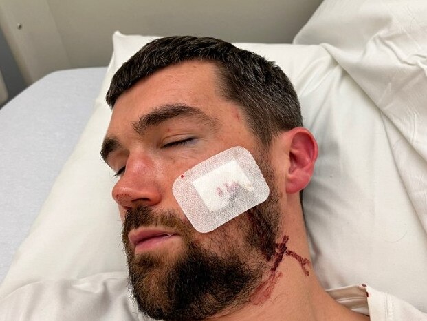 Socceroos captain Mat Ryan injury. Pic: X